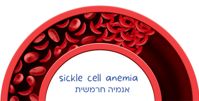 sickle cell anemia אנמיה חרמשית